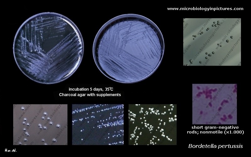 Bordetella Pertussis; The Causative Agent Of Pertussis(whooping Cough ...